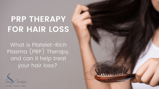 What Is PRP Therapy and Does It Really Help Treat Hair Loss?