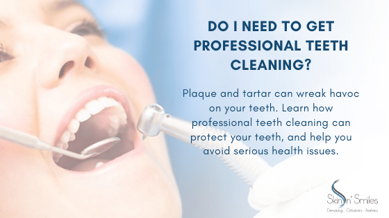 Do I Need To Get Professional Teeth Cleaning?