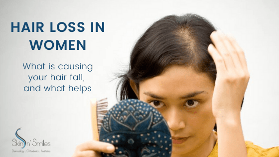 Hair Loss in Women – What is causing your hair fall, and what helps